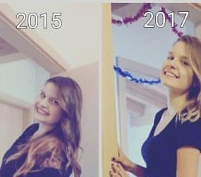 Vorher nachher Bild von Angela (2015 und 2017)